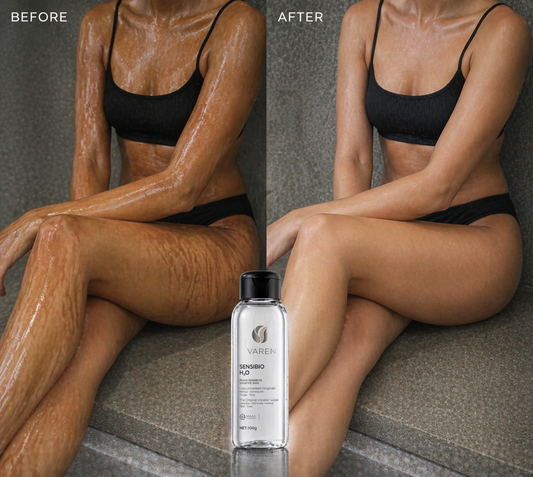 Varen® Skin Veil Remover