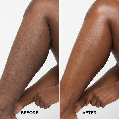 Varen® Skin Veil