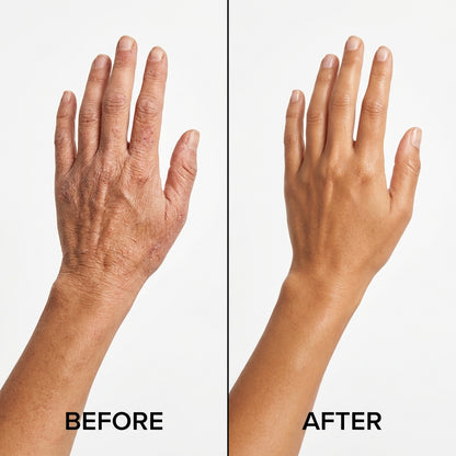 Varen® Skin Veil